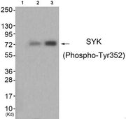 Western blot analysis of extracts from HuvEc cells (Lane 2) and HepG2 cells (Lane 3), using SYK (Phospho-Tyr352) Antibody. The lane on the left is treated with antigen-specific peptide.