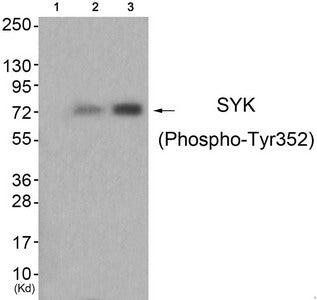 Western blot analysis of extracts from HuvEc cells (Lane 2) and HepG2 cells (Lane 3), using SYK (Phospho-Tyr352) Antibody. The lane on the left is treated with antigen-specific peptide.