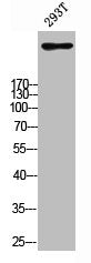 Western blot analysis of 293T using IP3R-I antibody. Antibody was diluted at 1:500. Secondary antibody was diluted at 1:20000