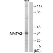 Western blot analysis of extracts from K562 cells, using MMTA2 antibody.