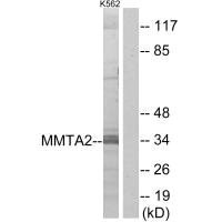 Western blot analysis of extracts from K562 cells, using MMTA2 antibody.
