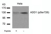Western blot analysis of extracts from Hela cells using ADD1(Phospho-Ser726) Antibody and the same antibody preincubated with blocking peptide.