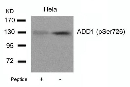Western blot analysis of extracts from Hela cells using ADD1(Phospho-Ser726) Antibody and the same antibody preincubated with blocking peptide.