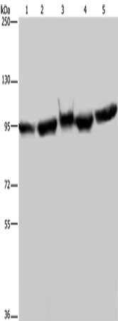 Gel: 6%SDS-PAGE, Lysate: 40 ug, Lane 1-5: A549 cells, 293T cells, mouse brain tissue, K562 cells, Hela cells, Primary antibody: CSB-PA557470(HSP90AA1 Antibody) at dilution 1/350, Secondary antibody: Goat anti rabbit IgG at 1/8000 dilution, Exposur...