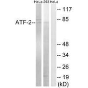 Western blot analysis of extracts from HeLa cells and 293 cells, using ATF-2 (Ab-472) antibody.