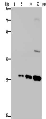 Gel: 8%SDS-PAGE, Lysate: 1,5,10,20 µg, Lane: GFP transfected 293T cells, Primary antibody: CSB-PA557657(GFP Antibody) at dilution 1/800, Secondary antibody: Goat anti rabbit IgG at 1/8000 dilution, Exposure time: 30 seconds