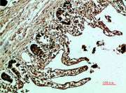 Immunohistochemical analysis of paraffin-embedded human-colon, antibody was diluted at 1:200