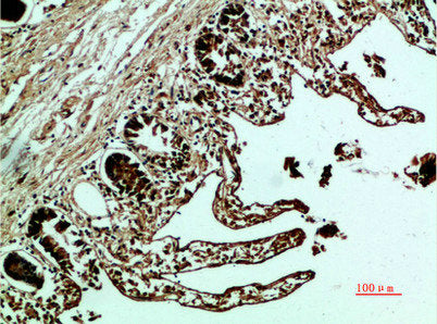Immunohistochemical analysis of paraffin-embedded human-colon, antibody was diluted at 1:200