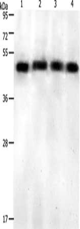Gel: 12%SDS-PAGE, Lysate: 40 µg, Lane 1-4: Jurkat cells, Hela cells, 231 cells, Mouse pancreas tissue, Primary antibody: CSB-PA558124(KISS1R Antibody) at dilution 1/500, Secondary antibody: Goat anti rabbit IgG at 1/8000 dilution, Exposure time: 1...