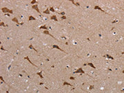 The image on the left is immunohistochemistry of paraffin-embedded Human brain tissue using CSB-PA558310(POMT1 Antibody) at dilution 1/40, on the right is treated with synthetic peptide. (Original magnification: ×200)