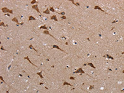 The image on the left is immunohistochemistry of paraffin-embedded Human brain tissue using CSB-PA558310(POMT1 Antibody) at dilution 1/40, on the right is treated with synthetic peptide. (Original magnification: ×200)