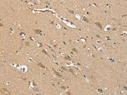 The image on the left is immunohistochemistry of paraffin-embedded Human brain tissue using CSB-PA558433(NES Antibody) at dilution 1/20, on the right is treated with synthetic peptide. (Original magnification: ×200)