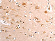 The image on the left is immunohistochemistry of paraffin-embedded Human brain tissue using CSB-PA558953(TRPV4 Antibody) at dilution 1/40, on the right is treated with fusion protein. (Original magnification: ×200)
