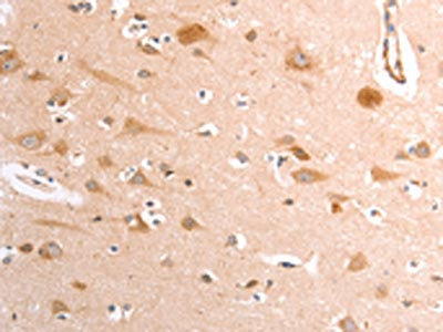 The image on the left is immunohistochemistry of paraffin-embedded Human brain tissue using CSB-PA558953(TRPV4 Antibody) at dilution 1/40, on the right is treated with fusion protein. (Original magnification: ×200)