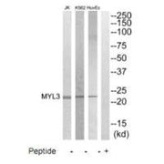 Western blot analysis of extracts from HuvEC, K562 and Jurkat cells, using MYL3 antibody.