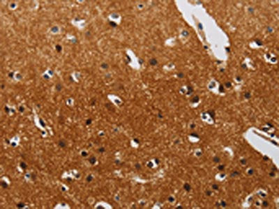 The image on the left is immunohistochemistry of paraffin-embedded Human brain tissue using CSB-PA559099(DTNBP1 Antibody) at dilution 1/20, on the right is treated with synthetic peptide. (Original magnification: ×200)
