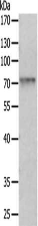 Gel: 10%SDS-PAGE, Lysate: 50 ug, Lane: 231 cells, Primary antibody: CSB-PA559119(PRMT7 Antibody) at dilution 1/400, Secondary antibody: Goat anti rabbit IgG at 1/8000 dilution, Exposure time: 40 seconds