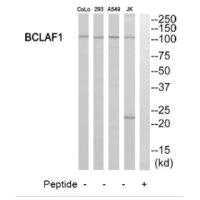 Western blot analysis of extracts from 293 cells, Jurkat cells and A549 cells, using BCLAF1 antibody.