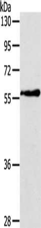 Gel: 6%SDS-PAGE, Lysate: 40 ug, Lane: Human fetal liver tissue, Primary antibody: CSB-PA560457(OLFM4 Antibody) at dilution 1/200, Secondary antibody: Goat anti rabbit IgG at 1/8000 dilution, Exposure time: 40 seconds