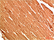 Immunohistochemical analysis of paraffin-embedded Human Skeletal Muscle Tissue using ATG13 Rabbit pAb diluted at 1:200