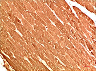 Immunohistochemical analysis of paraffin-embedded Human Skeletal Muscle Tissue using ATG13 Rabbit pAb diluted at 1:200