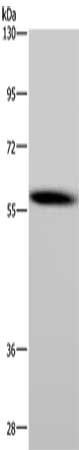 Gel: 6%SDS-PAGE, Lysate: 40 ug, Lane: Mouse lung tissue, Primary antibody: CSB-PA561026(CYP1A1 Antibody) at dilution 1/200, Secondary antibody: Goat anti rabbit IgG at 1/8000 dilution, Exposure time: 2 minutes