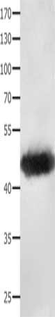 Gel: 10%SDS-PAGE, Lysate: 40 ug, Lane: Mouse liver tissue, Primary antibody: CSB-PA561453(MAT1A Antibody) at dilution 1/200, Secondary antibody: Goat anti rabbit IgG at 1/8000 dilution, Exposure time: 10 seconds