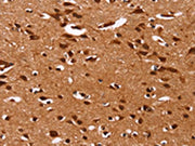 The image on the left is immunohistochemistry of paraffin-embedded Human brain tissue using CSB-PA561475(HRK Antibody) at dilution 1/40, on the right is treated with synthetic peptide. (Original magnification: ×200)