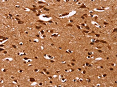 The image on the left is immunohistochemistry of paraffin-embedded Human brain tissue using CSB-PA561475(HRK Antibody) at dilution 1/40, on the right is treated with synthetic peptide. (Original magnification: ×200)