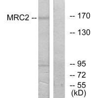 Western blot analysis of extracts from 293 cells, using MRC2 antibody.