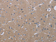 The image on the left is immunohistochemistry of paraffin-embedded Human brain tissue using CSB-PA561716(KLHL2 Antibody) at dilution 1/20, on the right is treated with fusion protein. (Original magnification: ×200)