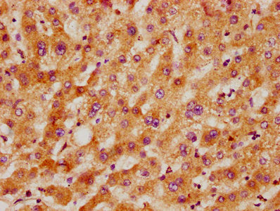 IHC image of CSB-PA5619A0Rb diluted at 1:300 and staining in paraffin-embedded human liver tissue performed on a Leica BondTM system. After dewaxing and hydration, antigen retrieval was mediated by high pressure in a citrate buffer (pH 6.0). Secti...