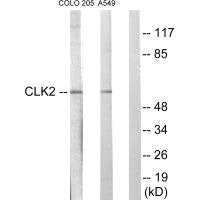 Western blot analysis of extracts from COLO205 cells and A549 cells, using CLK2 antibody.