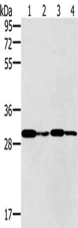 Gel: 10%SDS-PAGE, Lysate: 40 ug, Lane 1-4: K562 cells, human liver cancer tissue, Jurkat cells, A549 cells, Primary antibody: CSB-PA562058(PNMT Antibody) at dilution 1/400, Secondary antibody: Goat anti rabbit IgG at 1/8000 dilution, Exposure time...