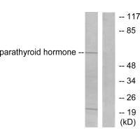 Western blot analysis of extracts from A549 cells, using Parathyroid Hormone antibody.