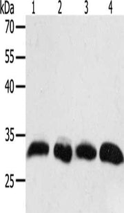 Gel: 10%SDS-PAGE, Lysate: 40 ug, Lane 1-4: Hela cells, A549 cells, human liver cancer tissue, lncap cells, Primary antibody: CSB-PA562484(PTGES2 Antibody) at dilution 1/550, Secondary antibody: Goat anti rabbit IgG at 1/8000 dilution, Exposure tim...