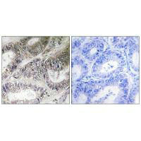 Immunohistochemistry analysis of paraffin-embedded human colon carcinoma tissue using COX19 antibody.