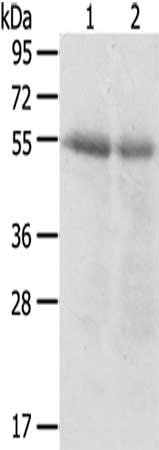 Gel: 8%SDS-PAGE,Lysate: 40 ug,Lane 1-2: Human right lung cancer tissue, Human left lung cancer tissue,Primary antibody: CSB-PA562640(SERINC3 Antibody) at dilution 1/200 dilution,Secondary antibody: Goat anti rabbit IgG at 1/8000 dilution,Exposure...
