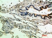 Immunohistochemical analysis of paraffin-embedded human-lung, antibody was diluted at 1:200
