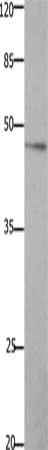 Gel: 10%SDS-PAGE, Lysate: 40 ug, Lane: 293T cells, Primary antibody: CSB-PA562807(GHSR Antibody) at dilution 1/1000, Secondary antibody: Goat anti rabbit IgG at 1/8000 dilution, Exposure time: 5 minutes