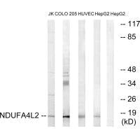 Western blot analysis of extracts from Jurkat cells, COLO cells, HUVEC cells and HepG2 cells, using NDUFA4L2 antibody.