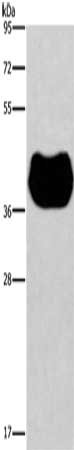 Gel: 8%SDS-PAGE, Lysate: 40 ug, Lane: Human fetal muscle tissue, Primary antibody: CSB-PA563350(HRH2 Antibody) at dilution 1/300, Secondary antibody: Goat anti rabbit IgG at 1/8000 dilution, Exposure time: 30 seconds