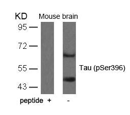 Western blot analysis of extracts from mouse brain tissue using Tau(Phospho-Ser396) Antibody and the same antibody preincubated with blocking peptide.