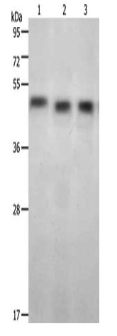 Gel: 12%SDS-PAGE, Lysate: 40 µg, Lane 1-4: Jurkat cells, Hela cells, 231 cells, Primary antibody: CSB-PA563634(KISS1R Antibody) at dilution 1/350, Secondary antibody: Goat anti rabbit IgG at 1/8000 dilution, Exposure time: 10 minutes
