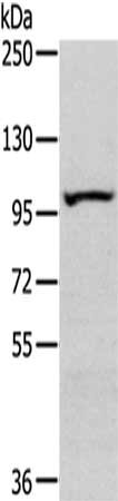Gel: 6%SDS-PAGE,Lysate: 40 ug,,Primary antibody: CSB-PA563802(SENP6 Antibody) at dilution 1/450 dilution,Secondary antibody: Goat anti rabbit IgG at 1/8000 dilution,Exposure time: 8 minutes