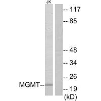 Western blot analysis of extracts from Jurkat cells, using MGMT antibody.