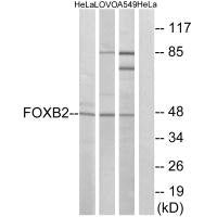 Western blot analysis of extracts from HeLa cells, LOVO cells and A549 cells, using FOXB2 antibody.