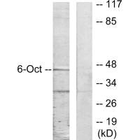 Western blot analysis of extracts from A549 cells, using OCT6 antibody.