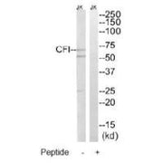 Western blot analysis of extracts from Jurkat cells, using CFI antibody.