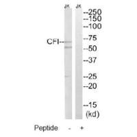 Western blot analysis of extracts from Jurkat cells, using CFI antibody.